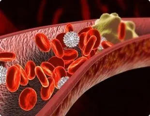 Coágulos de sangue bloqueando artéria