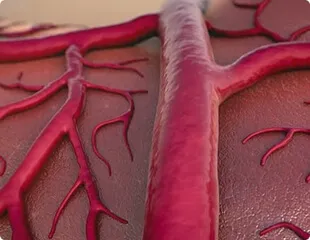 Vasos bloqueados e frágeis